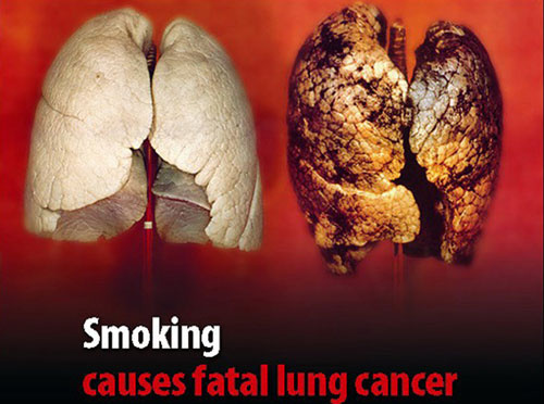 “吸烟有害健康”，众所周知，你真的了解吸烟的危害吗？
